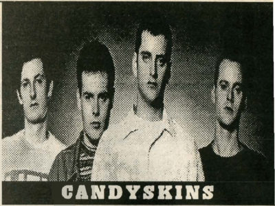 Interview with Candyskin: March 1993